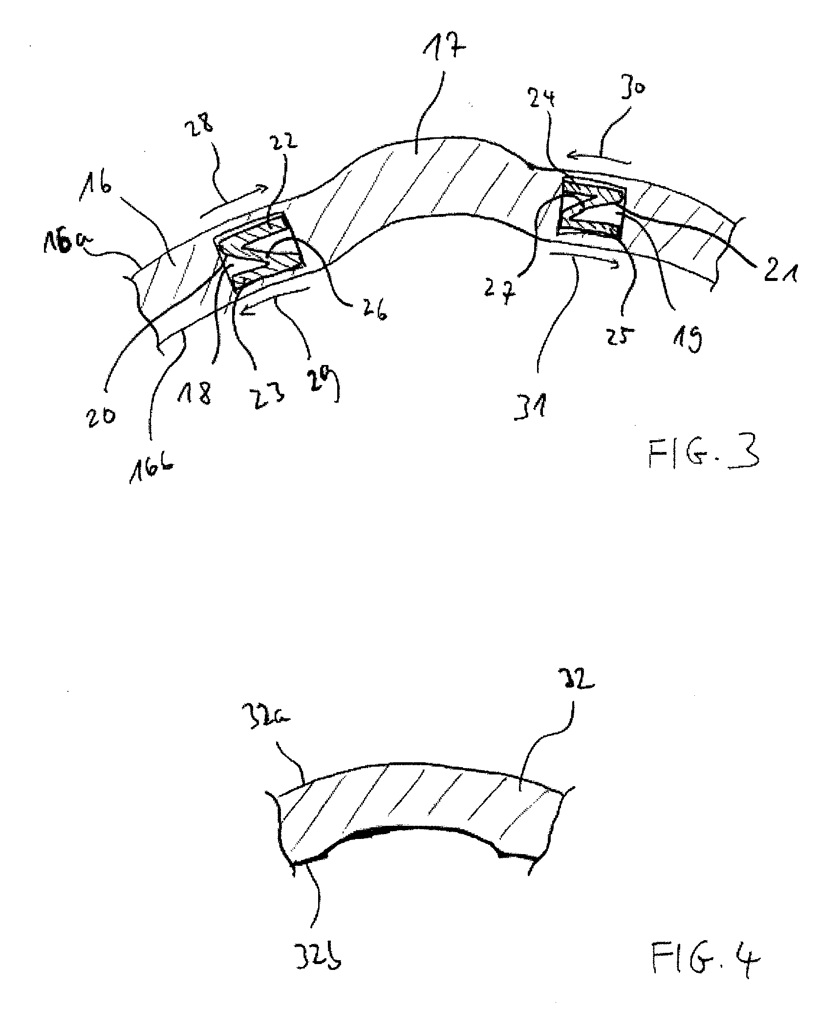 Means and Device for Compensating a Local Deformation of the Cornea of an Eye