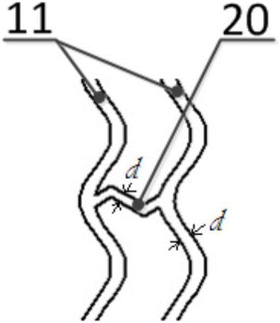 Intravascular stent and preparation method thereof