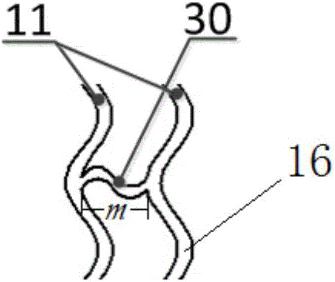 Intravascular stent and preparation method thereof