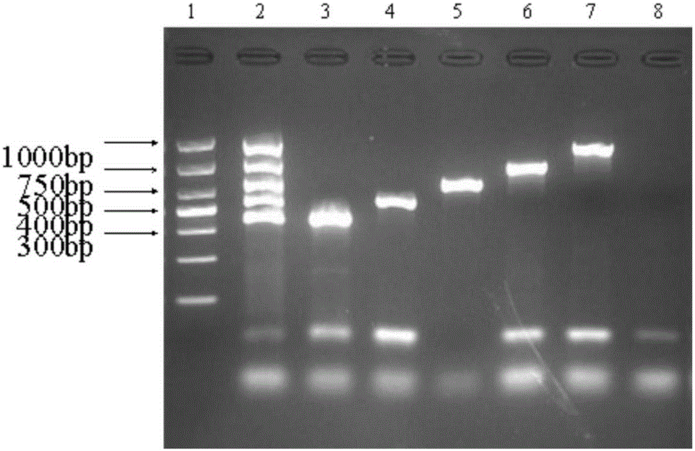 Detecting kit for five kinds of food-borne pathogenic bacteria and detection method