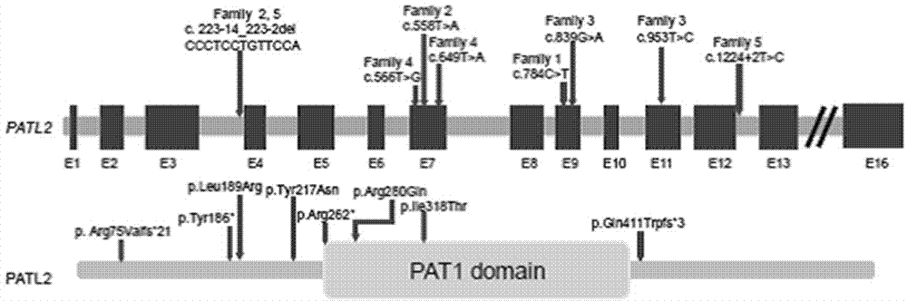 PATL2 gene for detecting female primary infertility and kit for detecting mutation of PATL2 gene