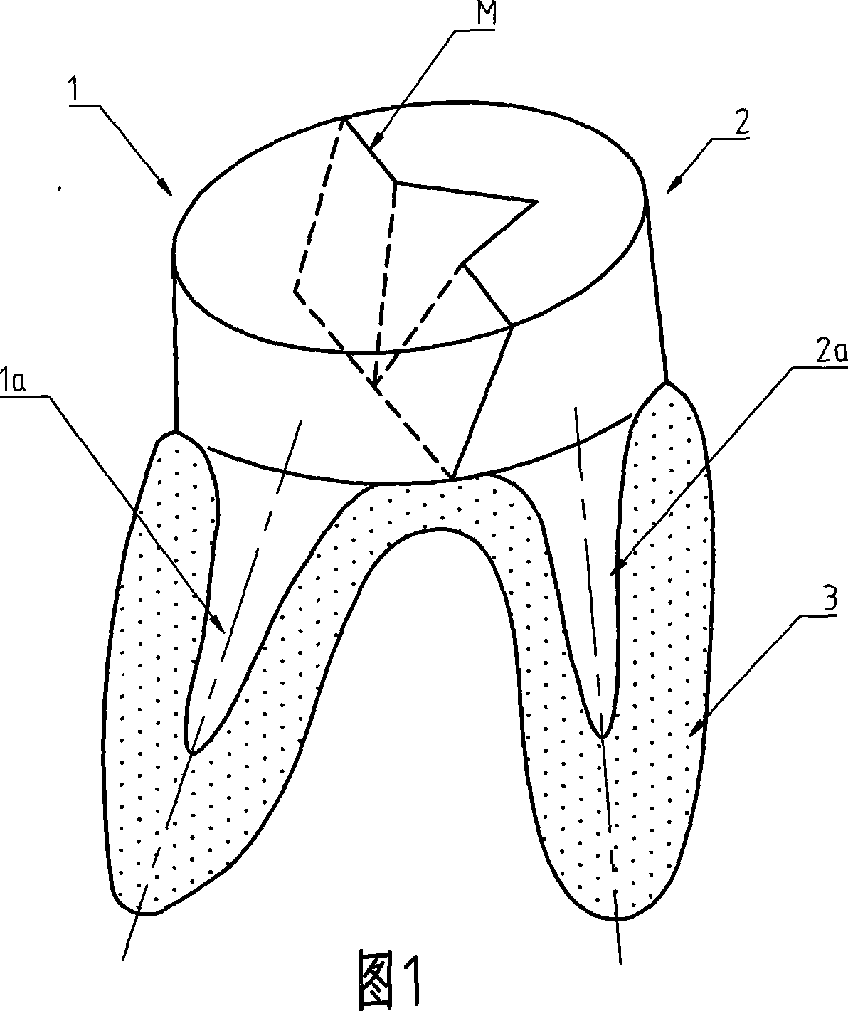 Molar fission molding pile-core and production method thereof