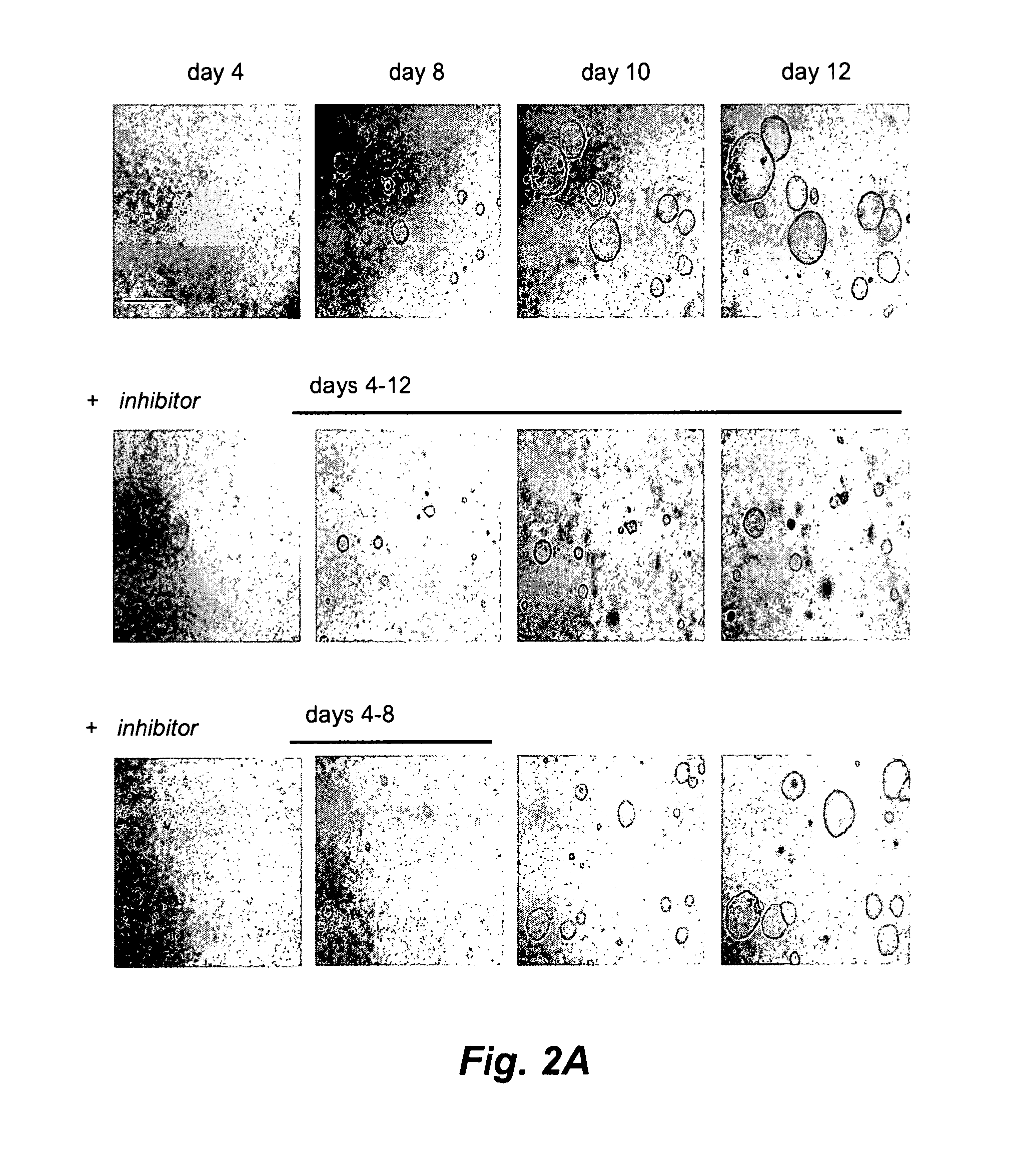 Water soluble small molecule inhibitors of the cystic fibrosis transmembrane conductance regulator