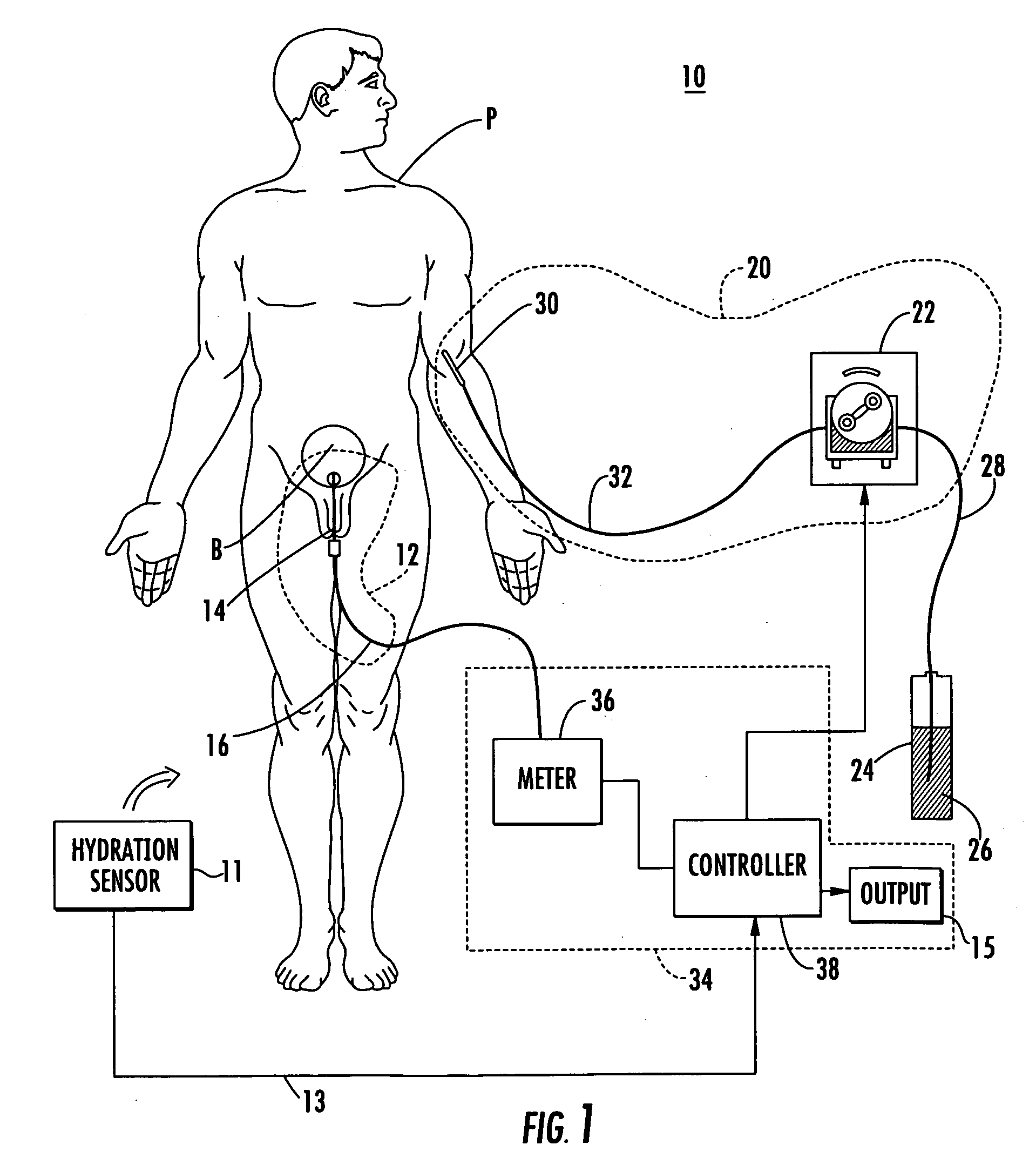 Patient hydration system with hydration state detection