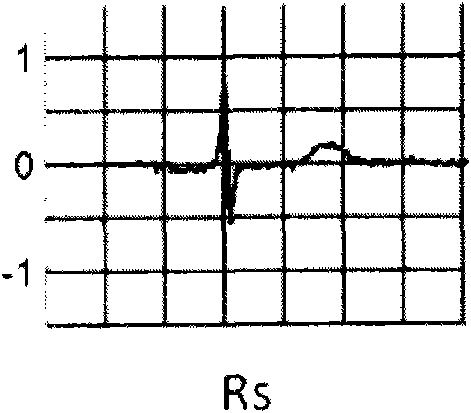Method and equipment for identification and classification of electrocardiogram