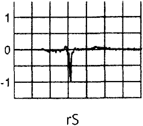 Method and equipment for identification and classification of electrocardiogram
