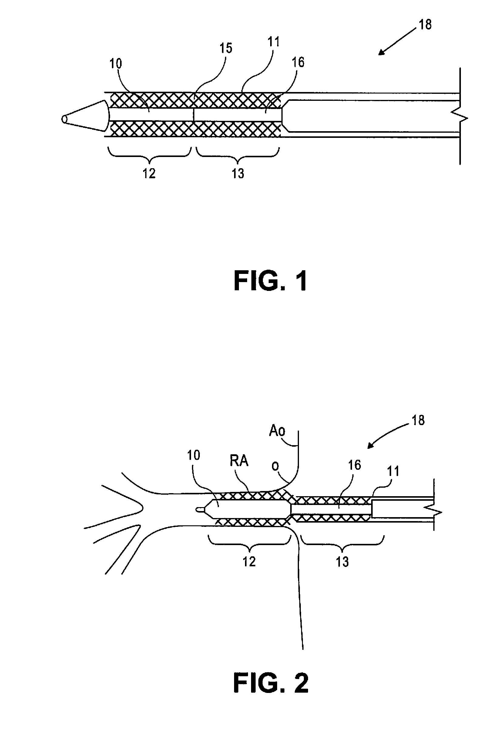 Stent and stent delivery system for side-branch locations in a conduit