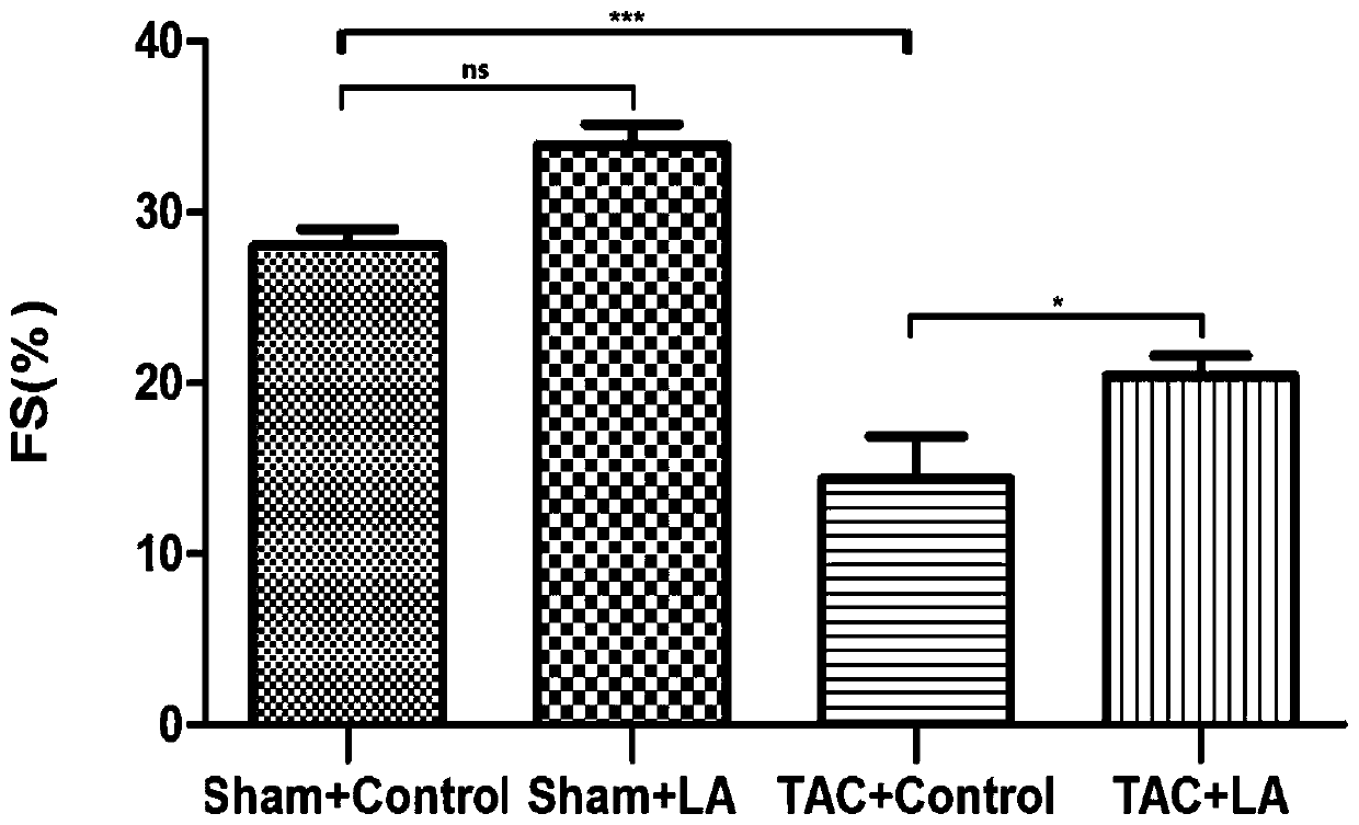 Application of Lipoic Acid in Preparation of Pharmaceutical Composition for Treating Pressure Load Myocardial Injury