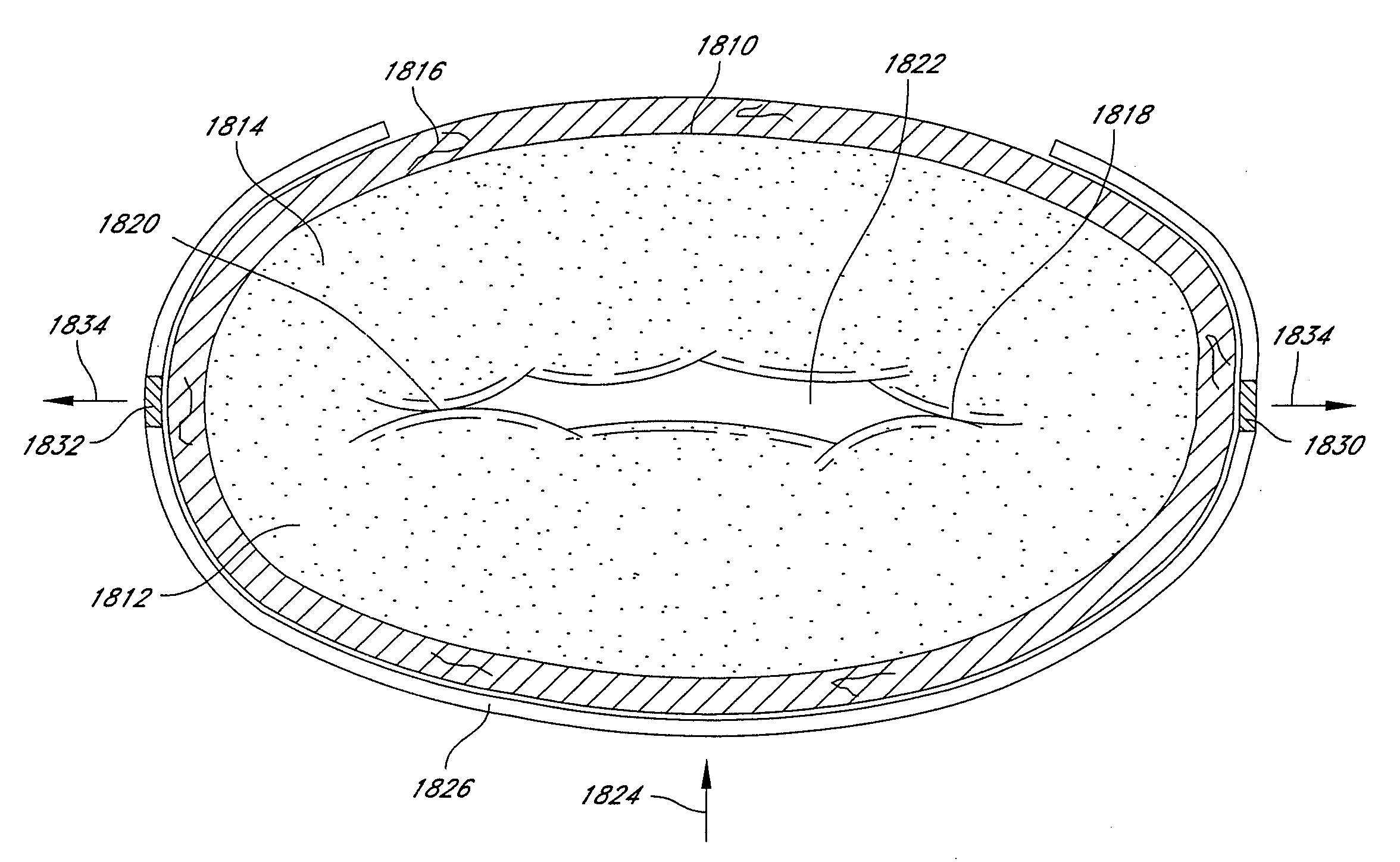 Adjustable annuloplasty ring and activation system
