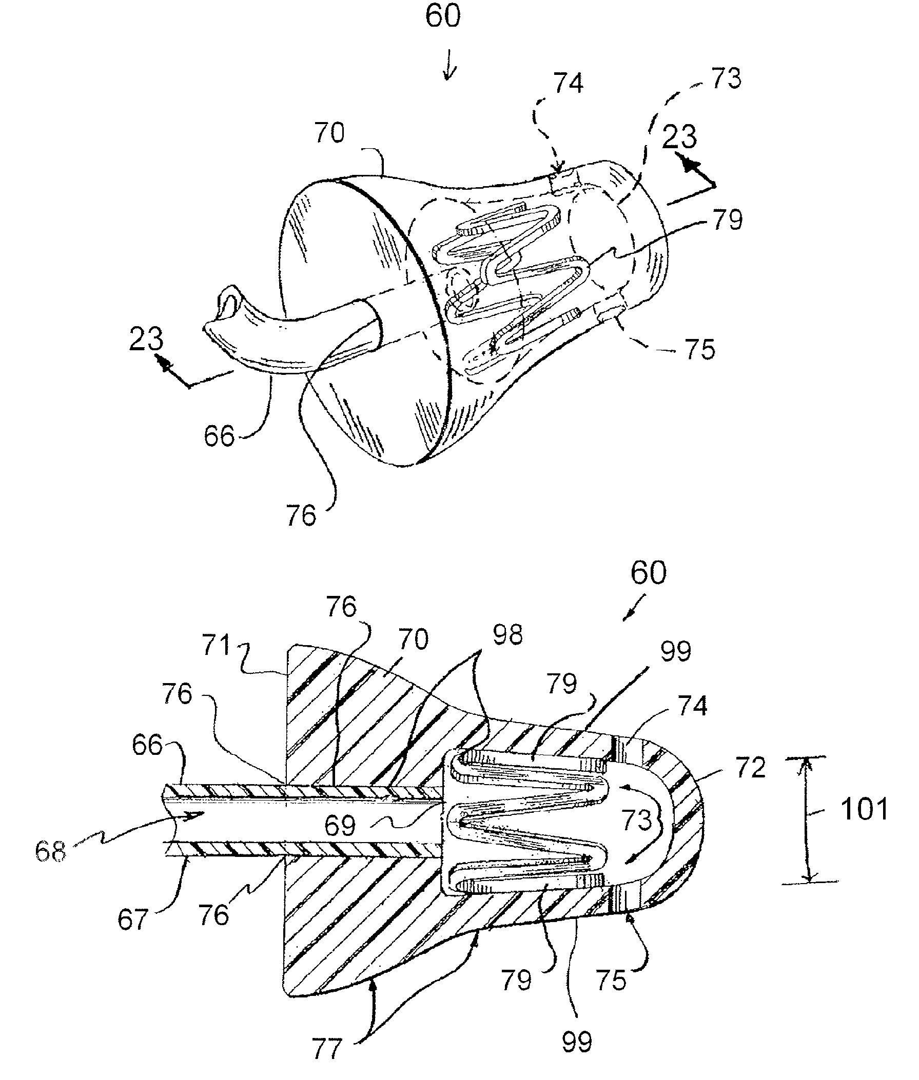 Self forming in-the-ear hearing aid with conical stent