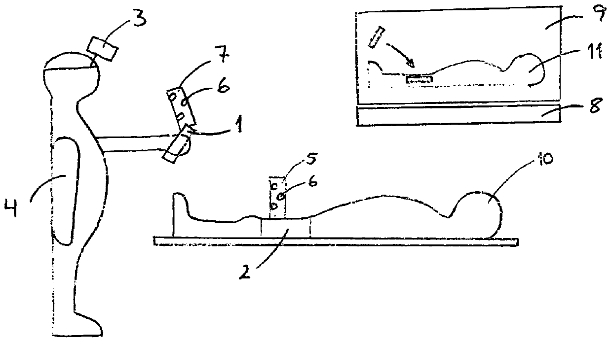 A system for precisely guiding a surgical procedure on a patient