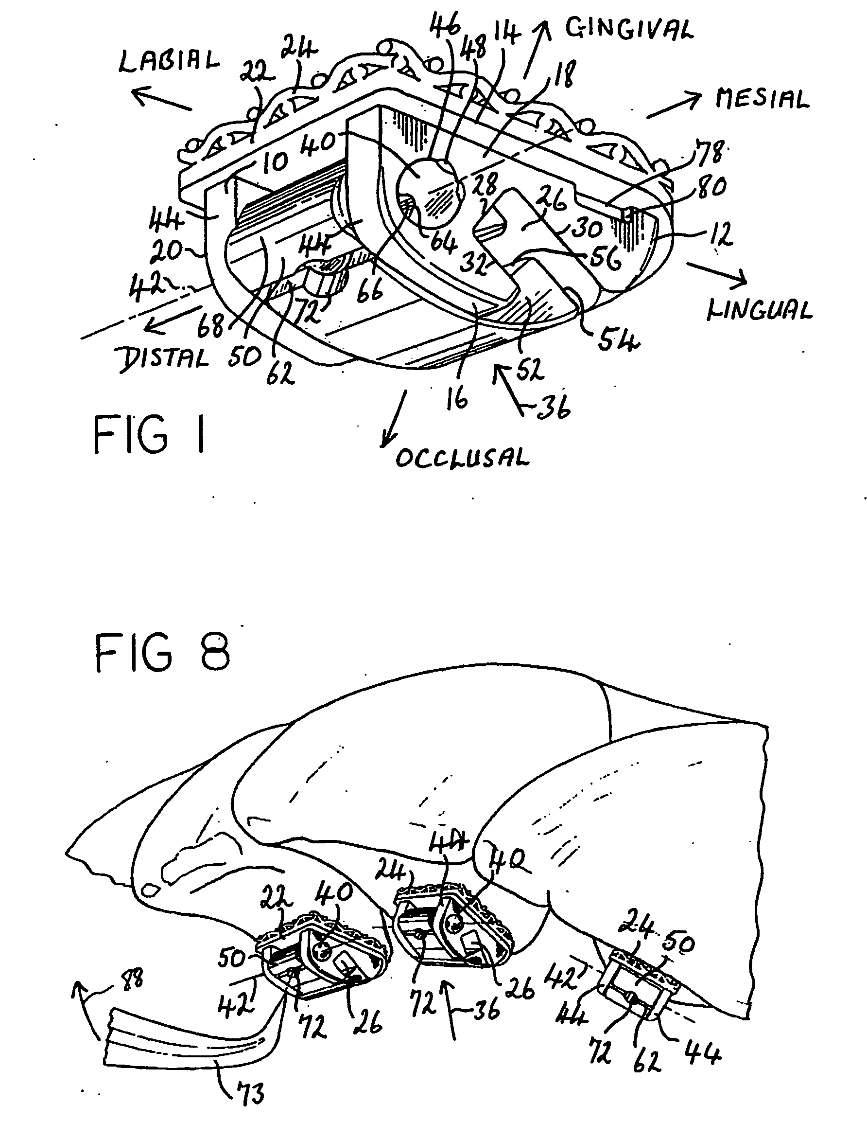 Orthodontic devices for use with arch wires