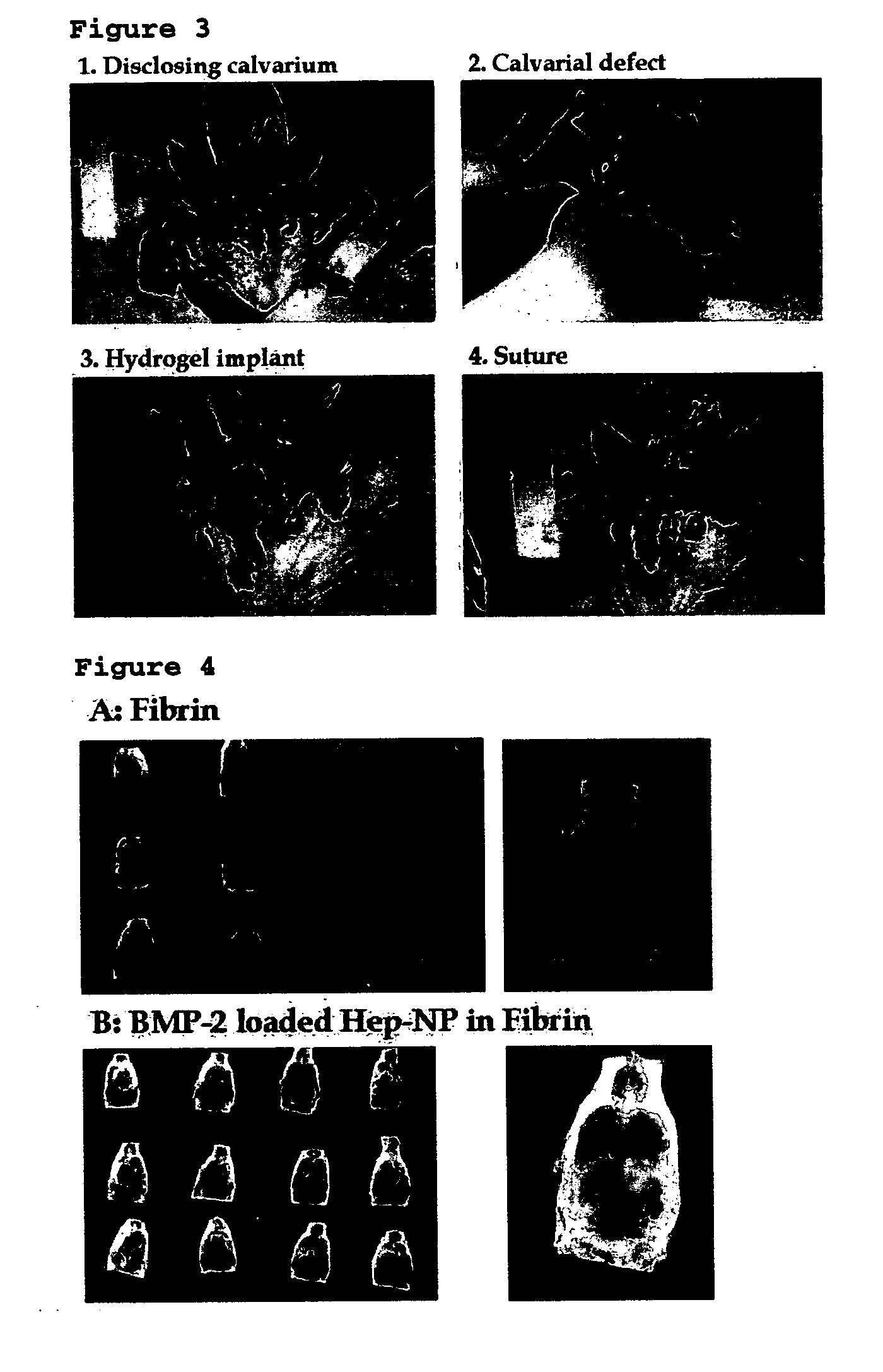 Composite comprising polysaccharide-functionalized nanoparticle and hydrogel matrix, a drug delivery system and a bone defect replacement matrix for sustained release comprising the same, and the preparation method thereof