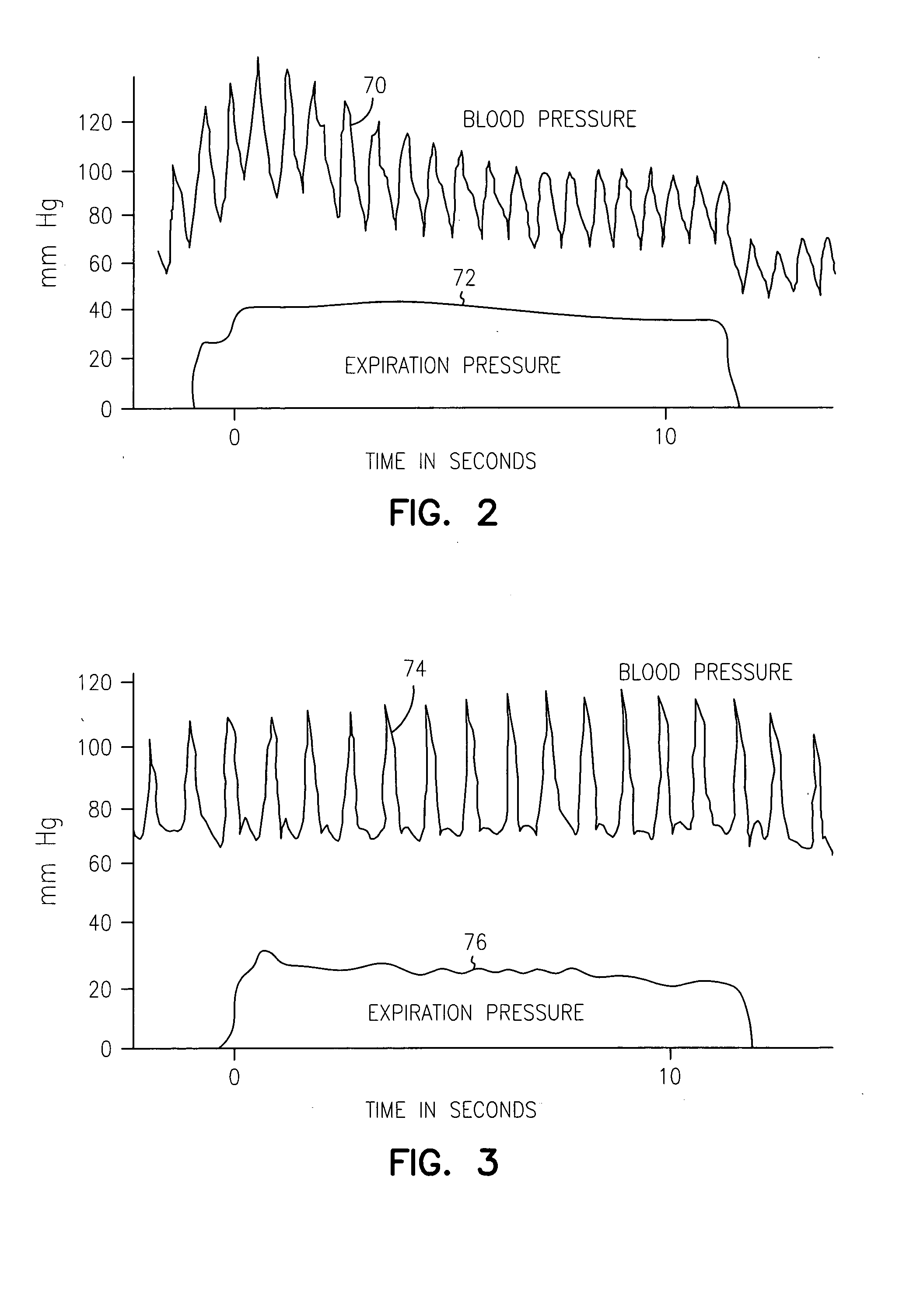 Non-invasive method and apparatus for cardiac pacemaker pacing parameter optimization and monitoring of cardiac dysfunction