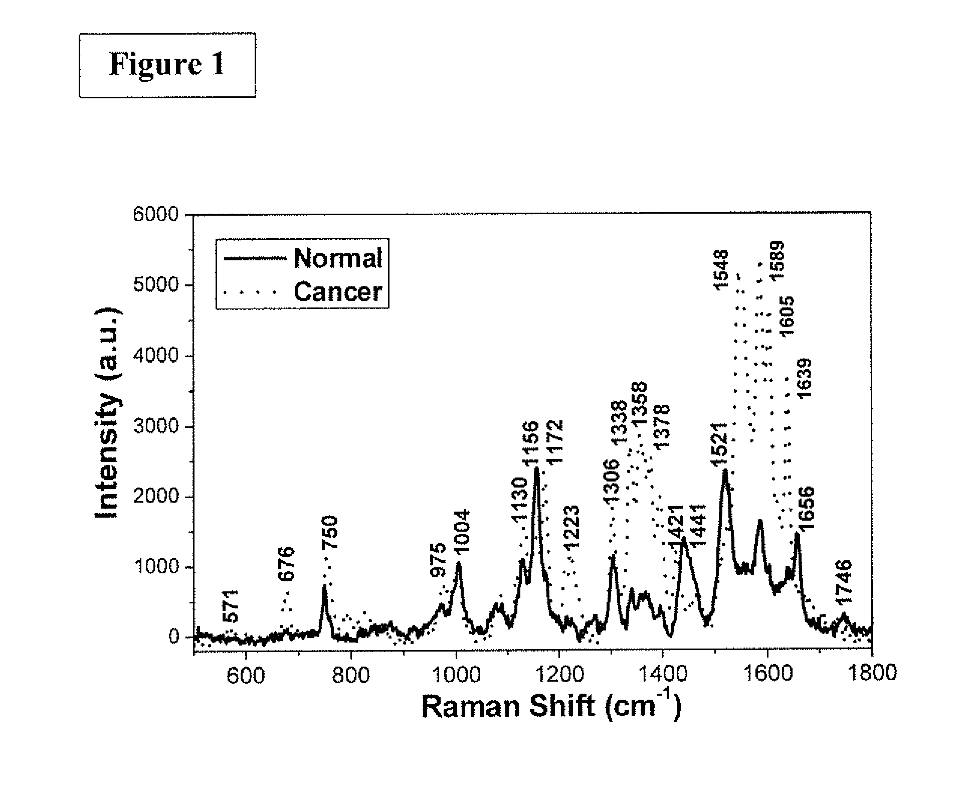 Resonance raman spectroscopy analyzer instrument for biomolecules in tissues and cells