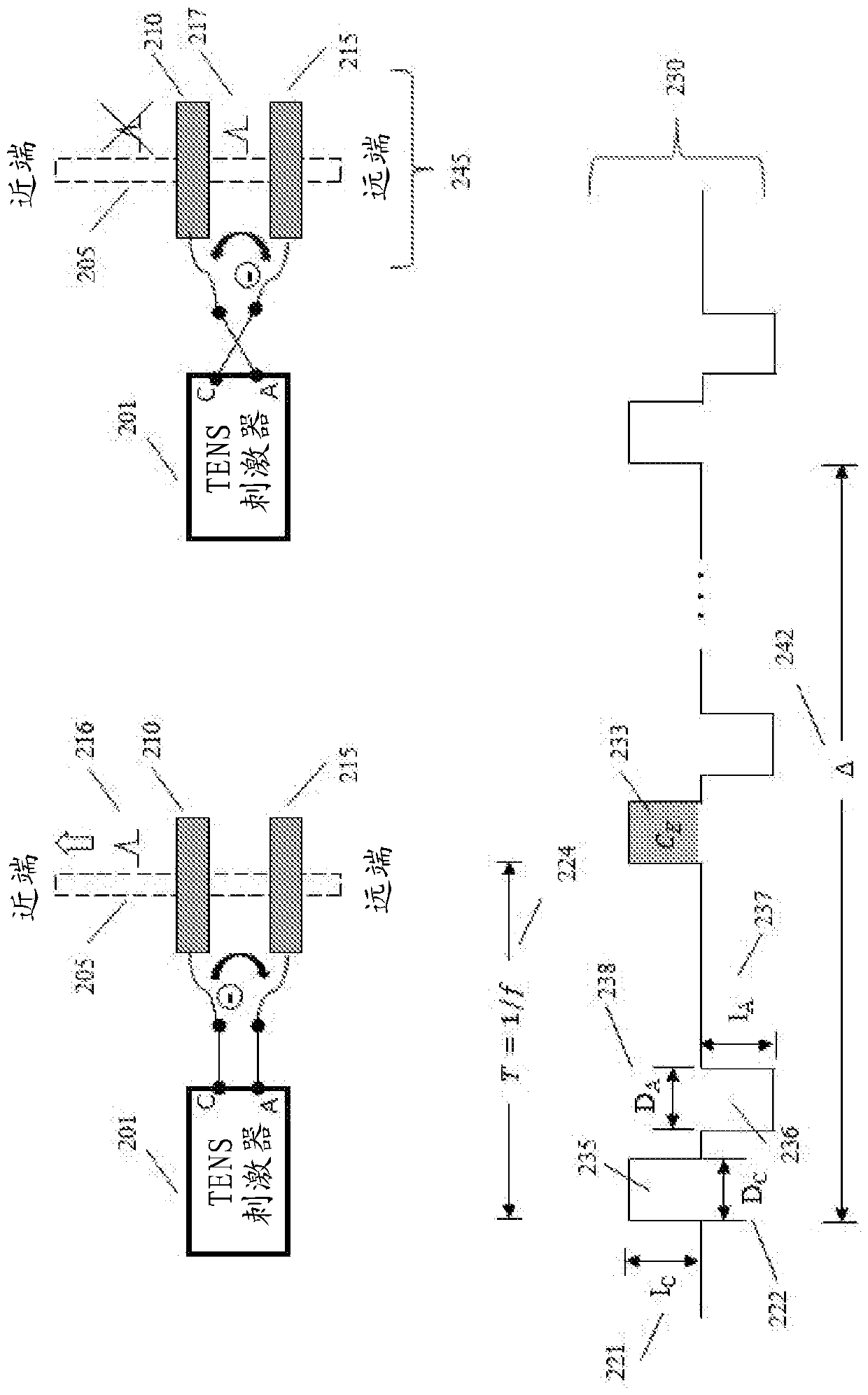 Transcutaneous electrical nerve stimulation using novel unbalanced biphasic waveform and novel electrode arrangement