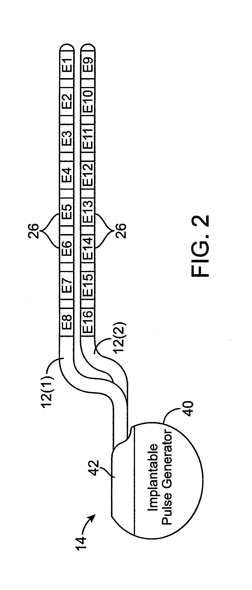 System and method for estimating lead configuration from neighboring relationship between electrodes