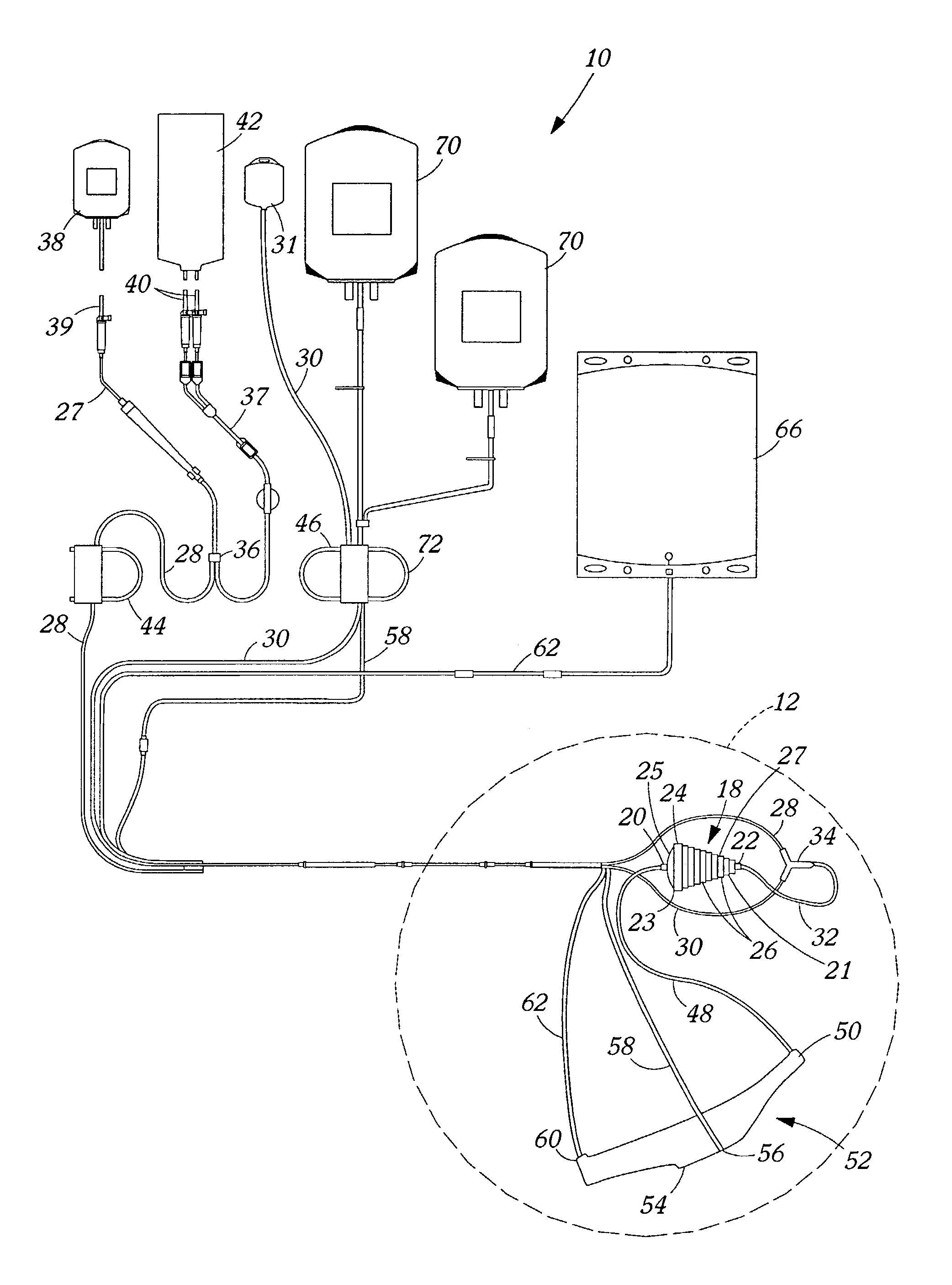 Methods and apparatus for separation of particles