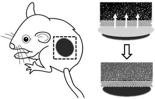 Anisotropic wound dressing and preparation method thereof