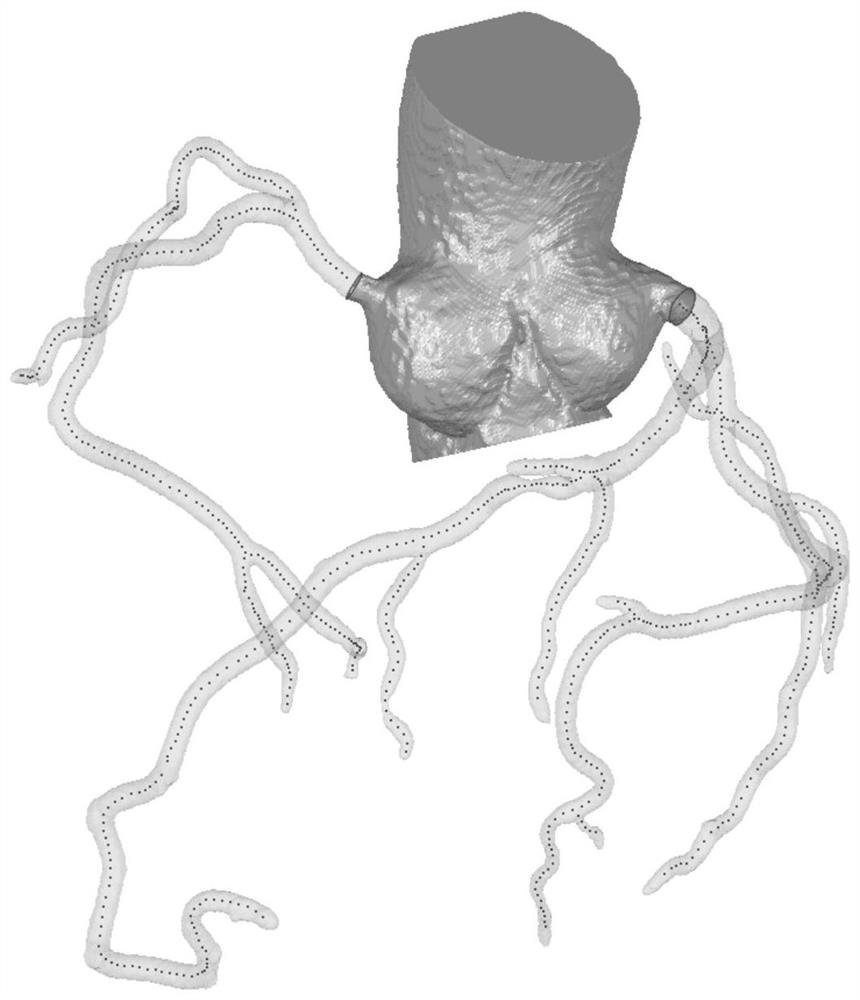 The system, method, equipment and storage media of the blood flow reserve score