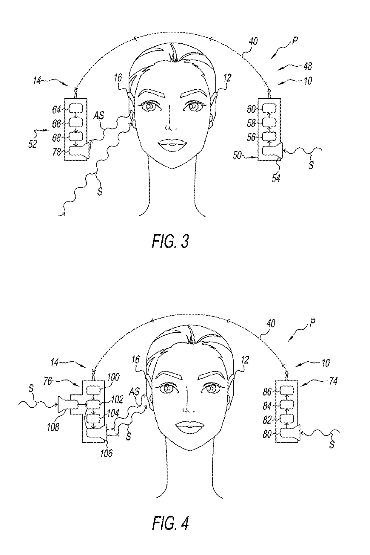 Hearing aid for people having asymmetric hearing loss