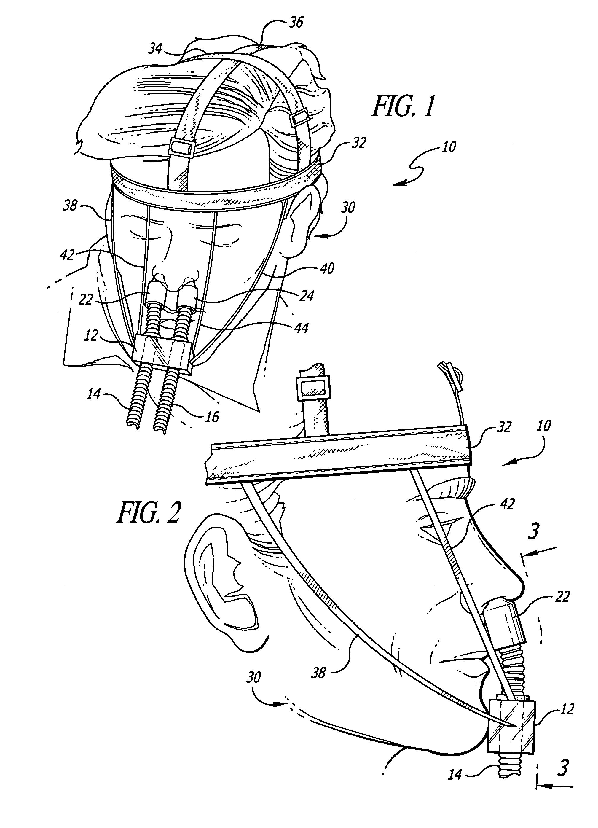 Adjustable support system for nasal breathing devices