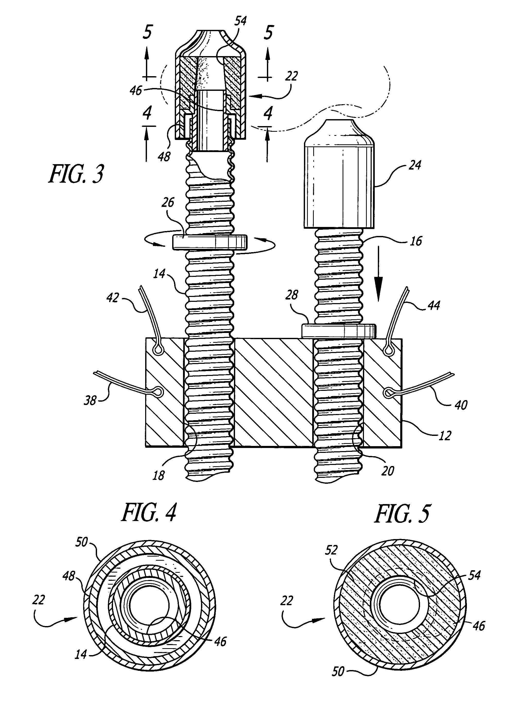 Adjustable support system for nasal breathing devices