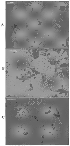 Dynein mosaic type recombinant human type-B adenovirus and preparation method thereof