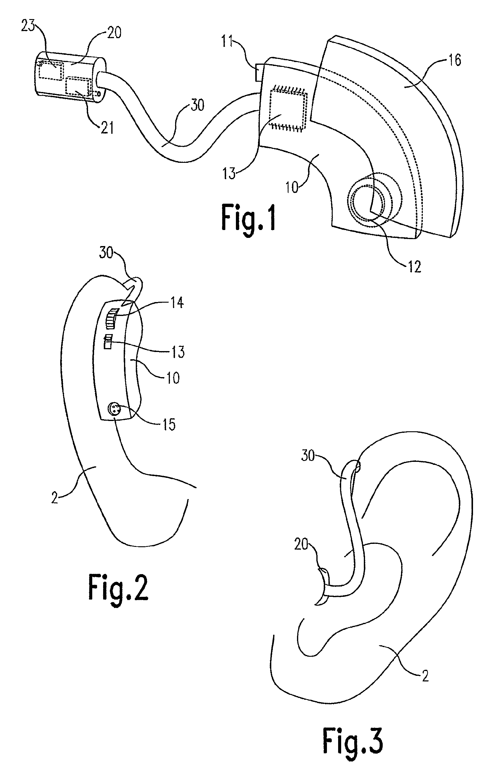 Hearing aid, expansion unit and method for manufacturing a hearing aid