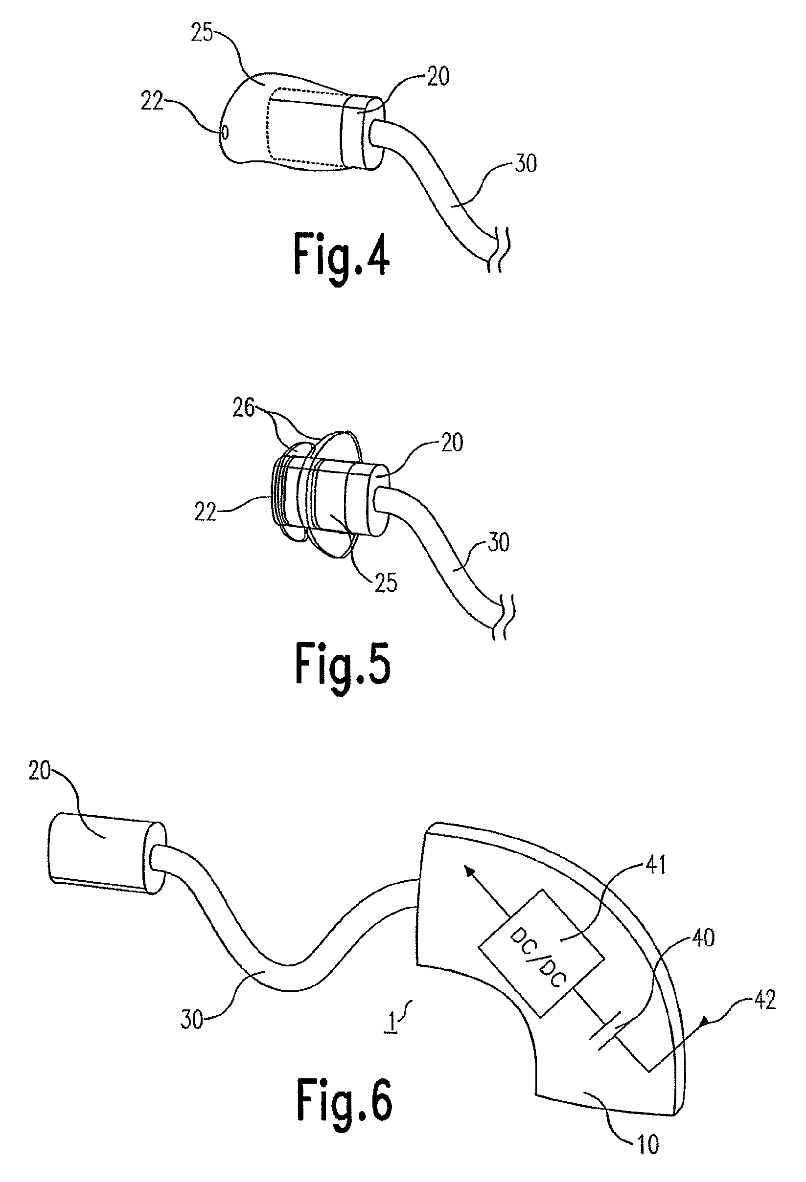 Hearing aid, expansion unit and method for manufacturing a hearing aid
