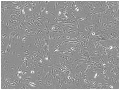 Human normal renal tubule primary cell and in-vitro isolated culture and application thereof