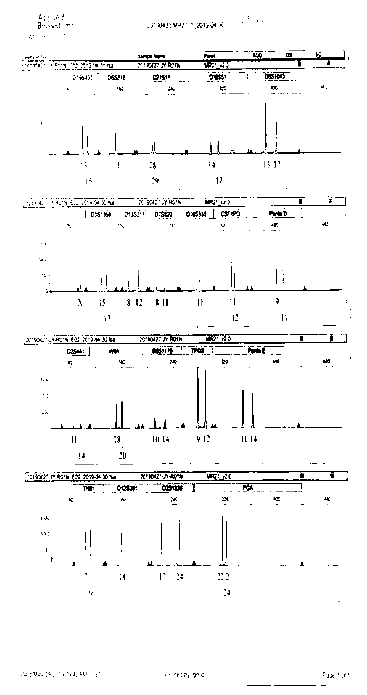 Human normal renal tubule primary cell and in-vitro isolated culture and application thereof