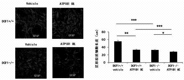 Application of dcf1 gene to regulate the expression of atp1b1