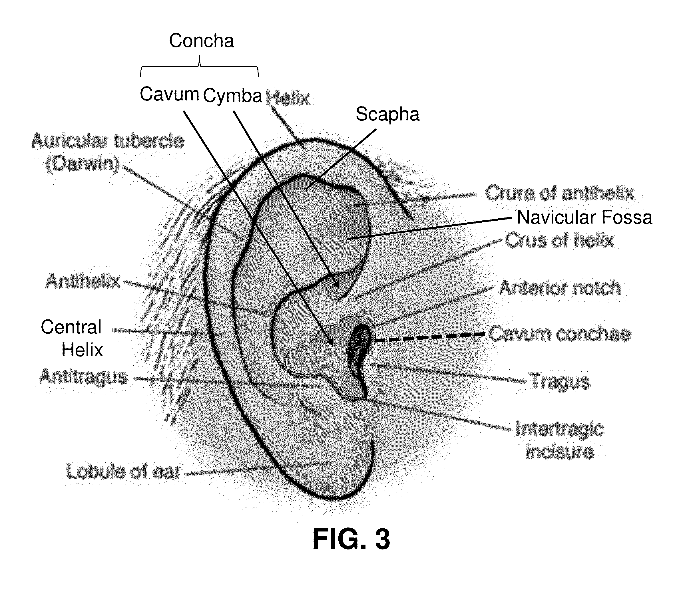Transcutaneous Electrostimulator and Methods for Electric Stimulation