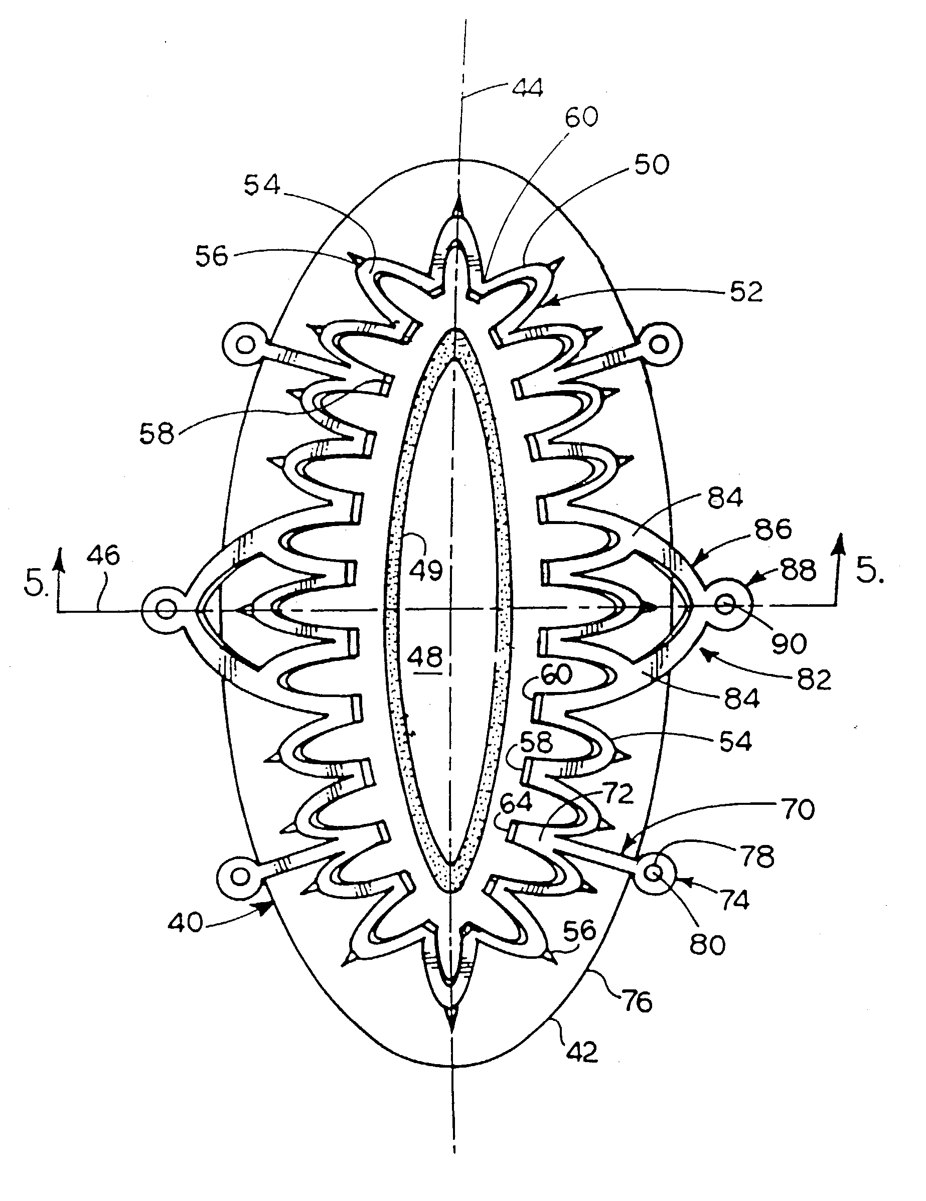 Apparatus and method for performing an anastomosis