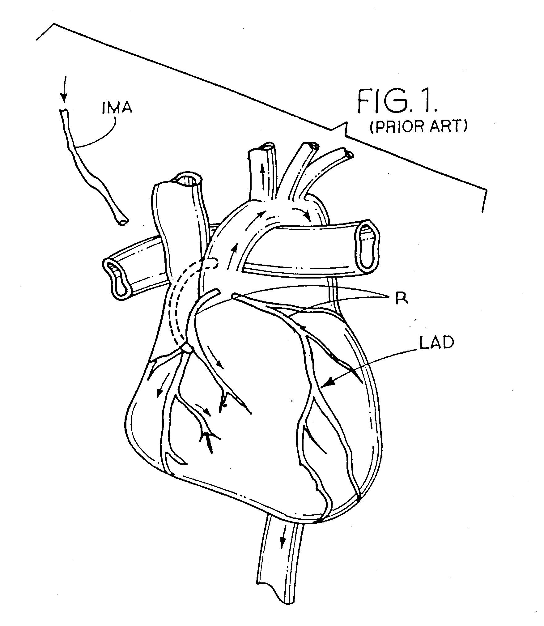 Apparatus and method for performing an anastomosis