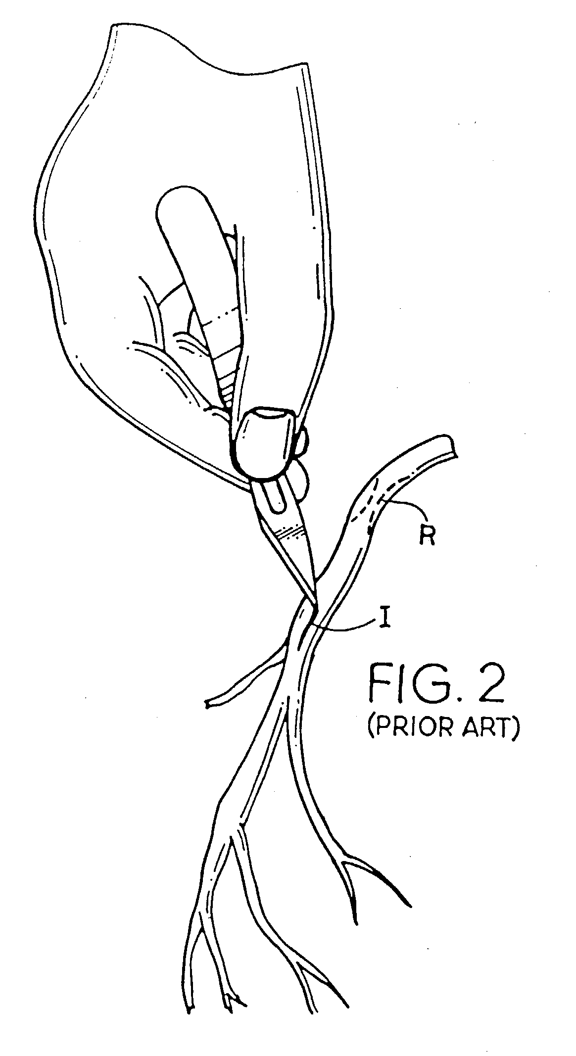 Apparatus and method for performing an anastomosis