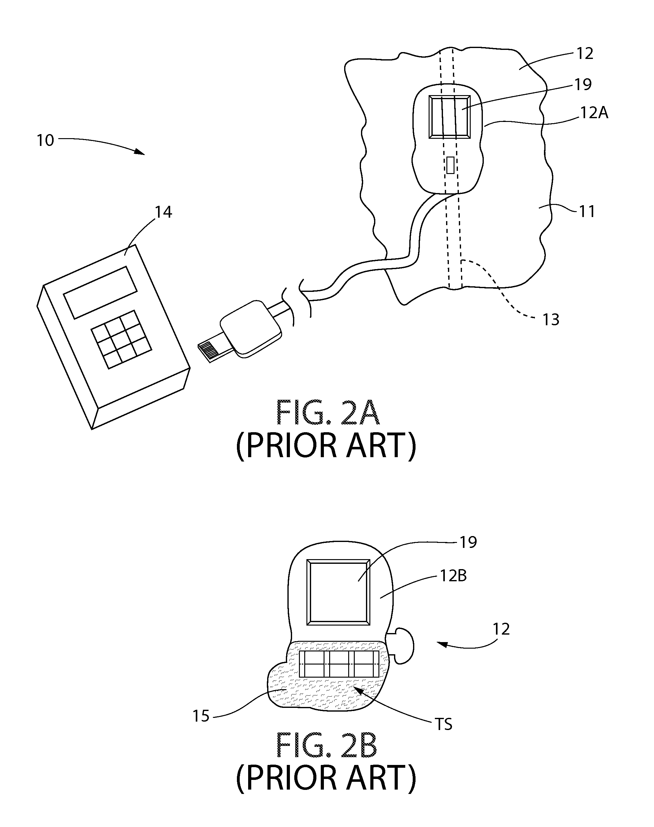 CSF shunt flow evaluation apparatus and method using a conformable expanded dynamic range thermosensor