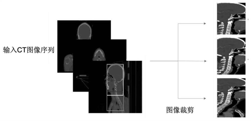 CT image-based nasopharyngeal carcinoma radiotherapy target region automatic sketching method