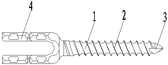 Multi-start thread U-shaped nail