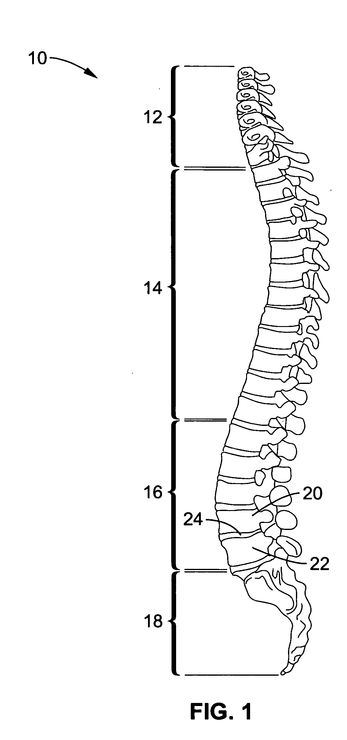 Spine microsurgery techniques, training aids and implants