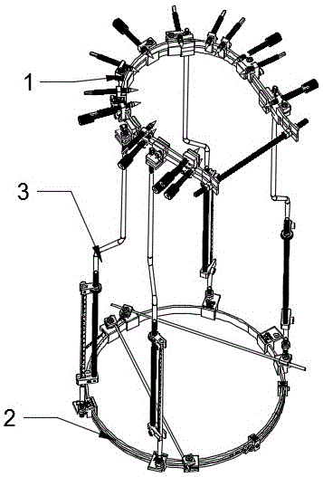 Adjustable fixing brace