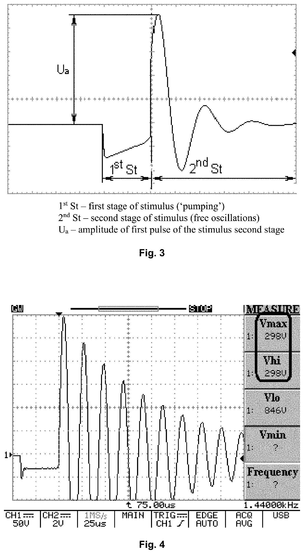 Method of searching optimal zones for electropulse therapy (variants)