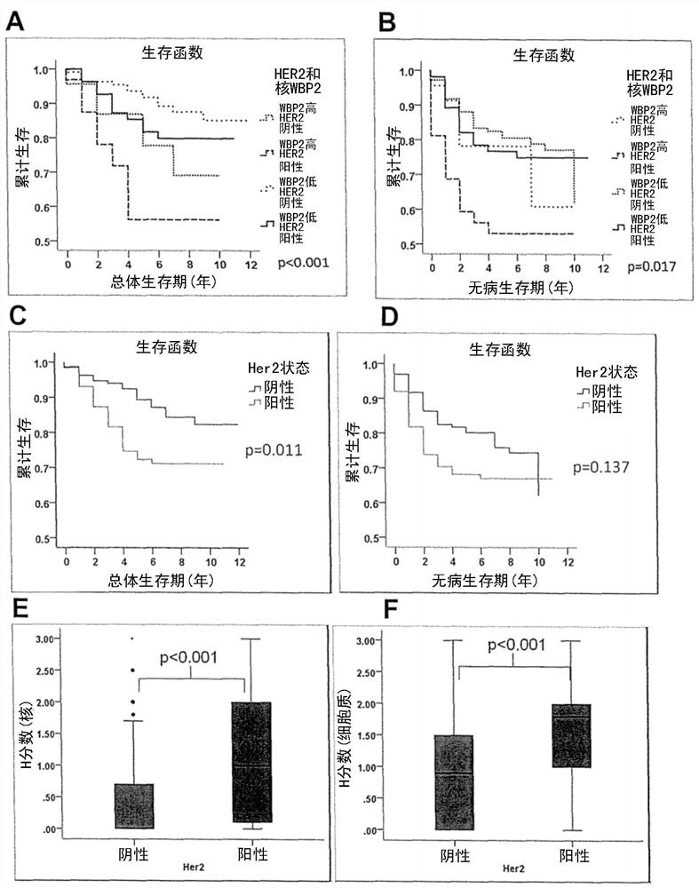 WBP2 and HER2 act as co-prognostic factors to stratify patients for treatment