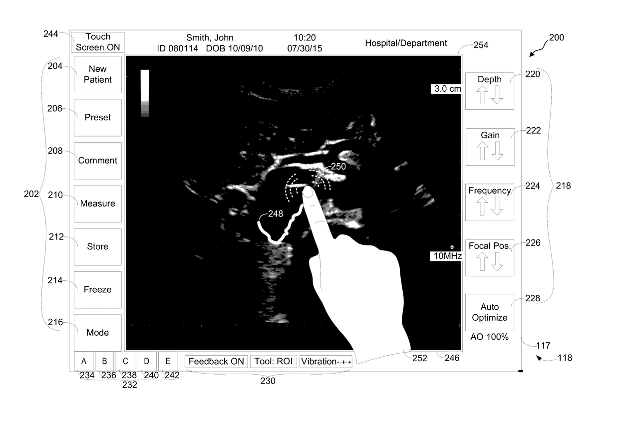 System and method for displaying and interacting with ultrasound images via a touchscreen