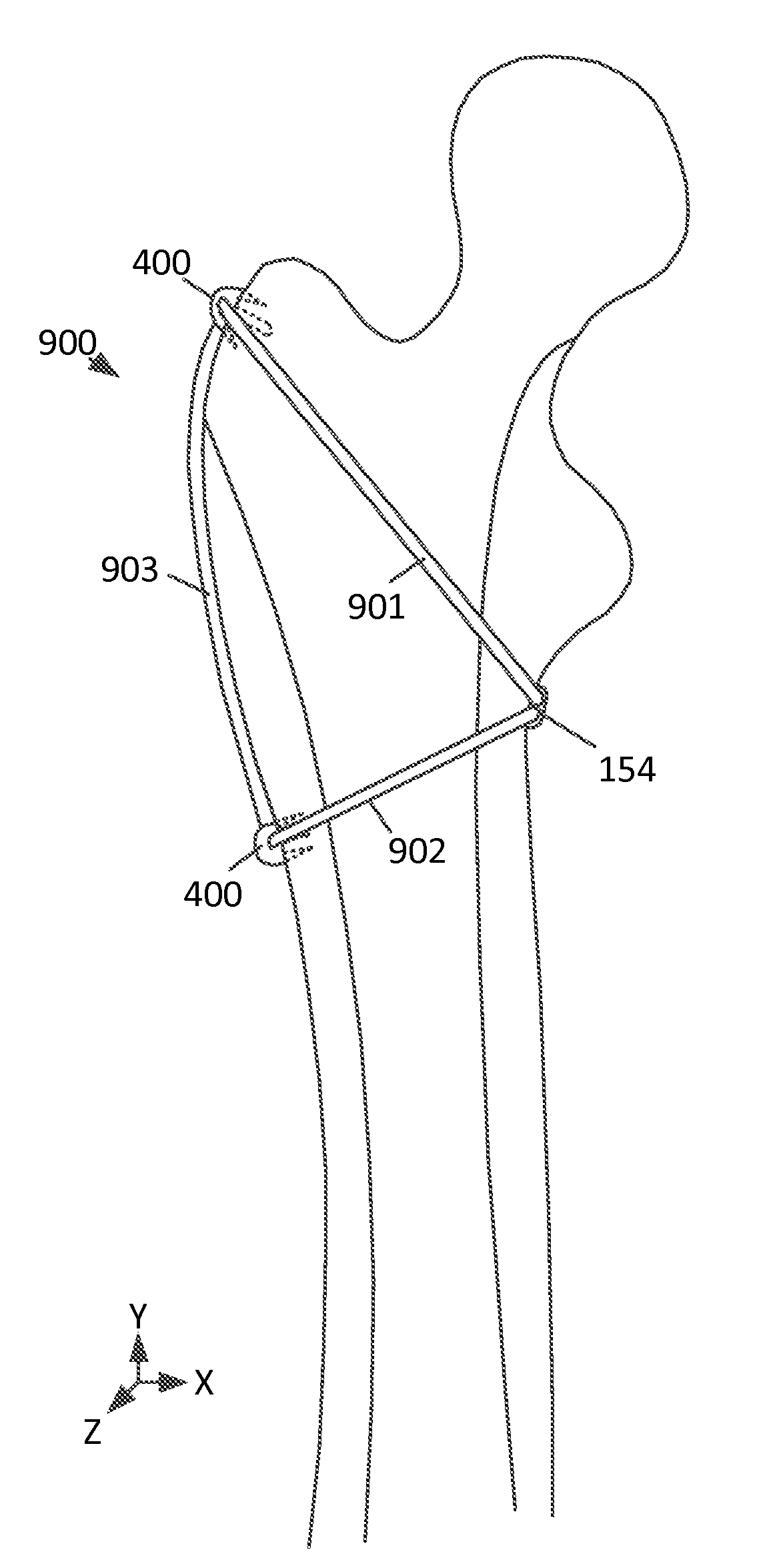 Cable anchor systems and methods