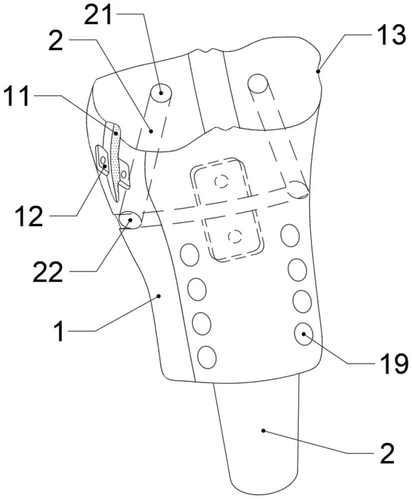 Anatomical bionic tibia near-end tumor semi-knee joint prosthesis