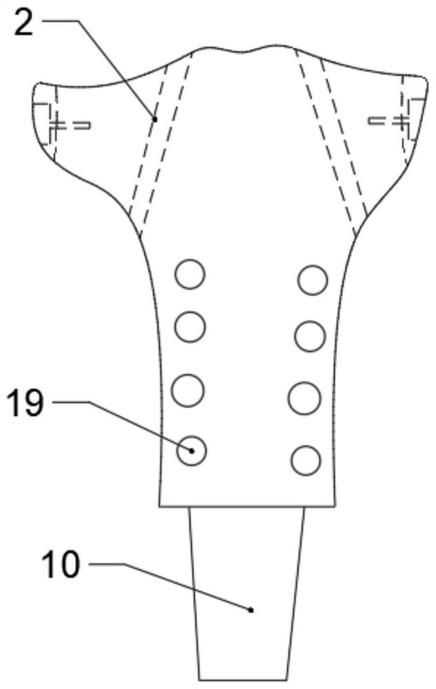 Anatomical bionic tibia near-end tumor semi-knee joint prosthesis