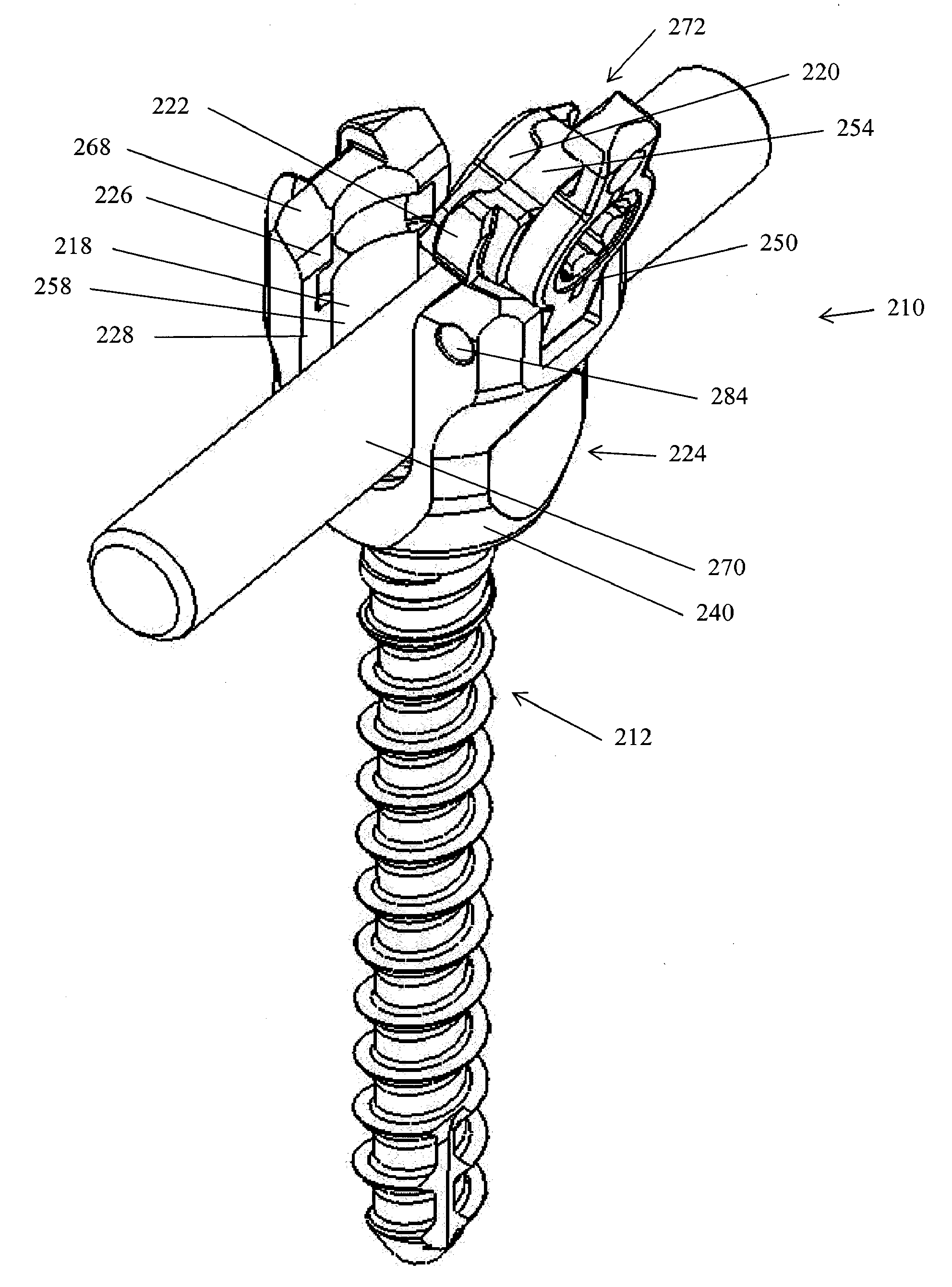 Spinal stabilization device