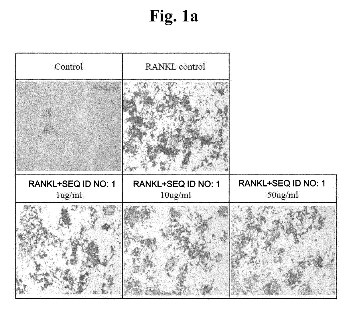 Peptide having osteoclast differentiation and activation inhibition, and use of same